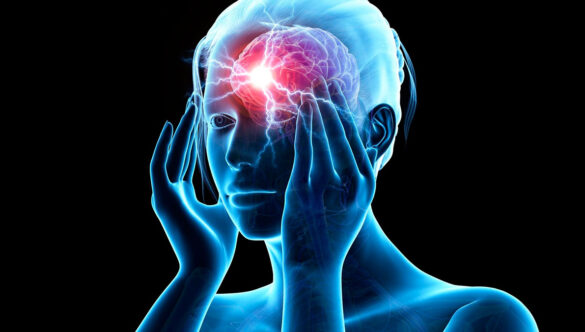 Migren Nedir? Migrene Ne İyi Gelir
